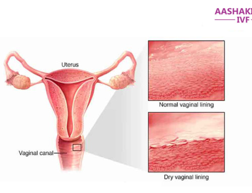 Atrophic Uterus